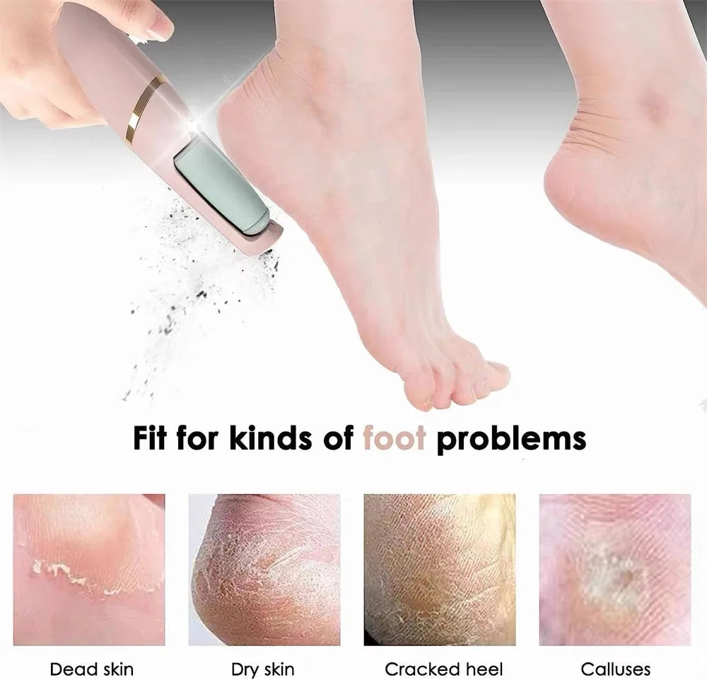Electric Foot Grinder for Dead Skin Rechargeable Roller Feet Pedicure Tool with Removable Roller Heads